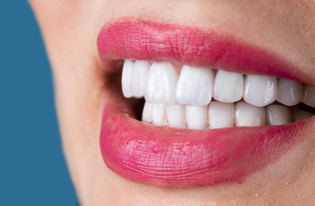 Tooth-Colored Fillings in West Allis – Natural Solutions for Cavities veneers 6