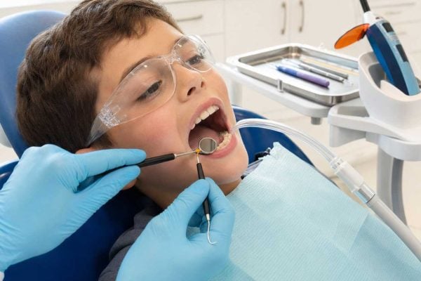 Protective-dental-sealants